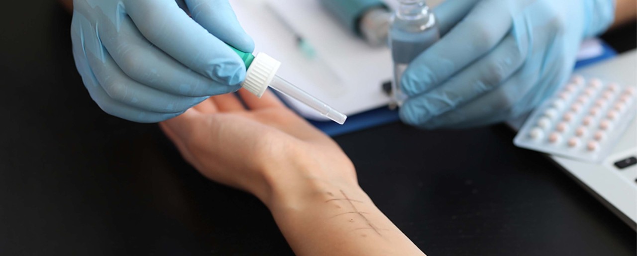 Administering an allergy test to an arm